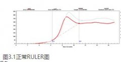 潤滑油檢測(cè)中抗氧化劑含量(RULER)是什么？